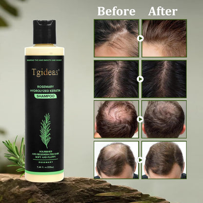 Rosemary Anti-Hair Fall Formula